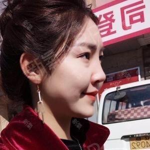 陈丹婷整容是真的吗？网友：变化太大认不出！